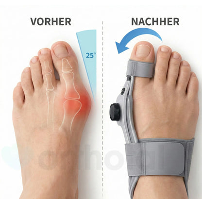 Orthotal BallenKorrektor